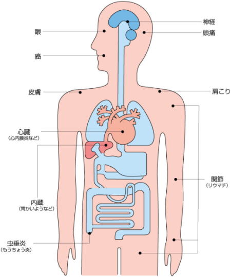 西条市 東予歯科 歯と体への影響